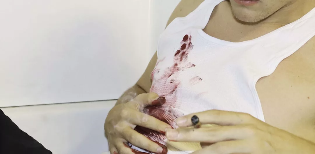 Eine Person in einem weißen, blutbefleckten Tank-Top sitzt mit einer Zigarette in der Hand, GLAMESiA ist dezent auf den Stoff geätzt, Blut verschmiert ihre Hände und ihren Oberkörper.